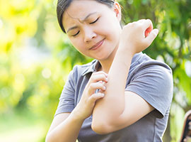 Una joven rascándose el brazo con una picadura de mosquito al aire libre.
